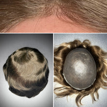 Skin Toupee Medium