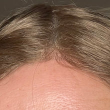 Skin Toupee Medium